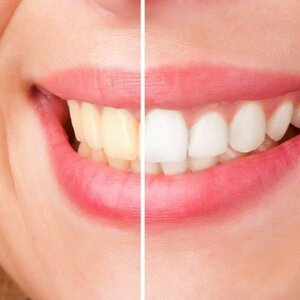 Mondzorg Teakhout B.V. image 2